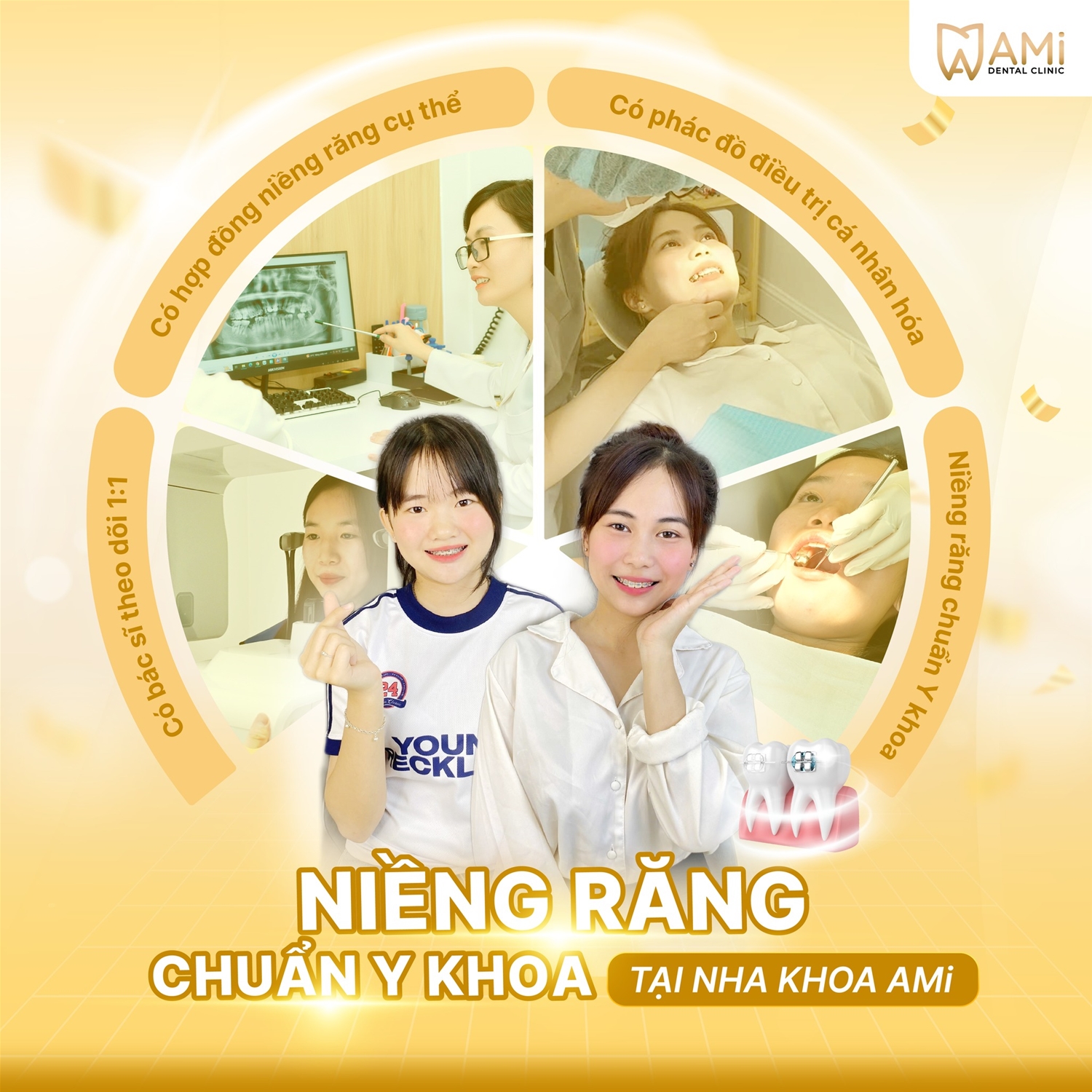 niềng răng chuyên sâu tại phan thiết-nha khoa ami